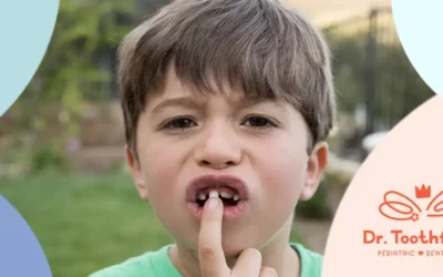 Broken Tooth Repair Options