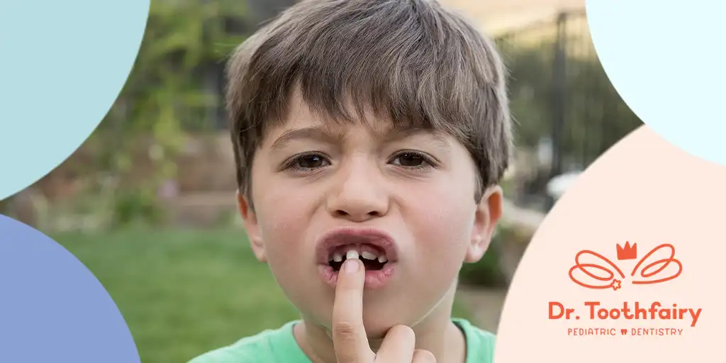 Child with a broken tooth